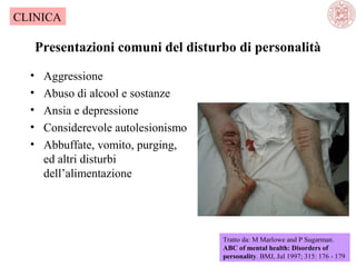 CLINICA

Presentazioni comuni del disturbo di personalità
•
•
•
•
•

Aggressione
Abuso di alcool e sostanze
Ansia e depressione
Considerevole autolesionismo
Abbuffate, vomito, purging,
ed altri disturbi
dell’alimentazione

Tratto da: M Marlowe and P Sugarman.
ABC of mental health: Disorders of
personality. BMJ, Jul 1997; 315: 176 - 179

 