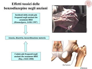 Effetti tossici delle
benzodiazepine negli anziani
Incidenti della strada più
frequenti negli anziani che
assumono BDZ
(Hemmelgarn, JAMA 1997)

Atassia, disartria, incoordinazione motoria

Cadute più frequenti negli
anziani che assumono BDZ
(Ray, JAGS 2000)

 
