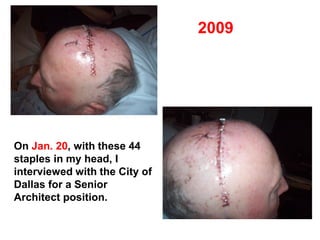 On Jan. 20, with these 44
staples in my head, I
interviewed with the City of
Dallas for a Senior
Architect position.
2009
 