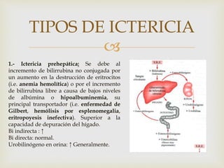 
TIPOS DE ICTERICIA
1.- Ictericia prehepática: Se debe al
incremento de bilirrubina no conjugada por
un aumento en la destrucción de eritrocitos
(i.e. anemia hemolítica) o por el incremento
de bilirrubina libre a causa de bajos niveles
de albúmina o hipoalbuminemia, su
principal transportador (i.e. enfermedad de
Gilbert, hemólisis por esplenomegalia,
eritropoyesis inefectiva). Superior a la
capacidad de depuración del hígado.
Bi indirecta : ↑
Bi directa: normal.
Urobilinógeno en orina: ↑ Generalmente.
 