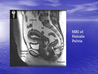 MRI of
Female
Pelvis
 
