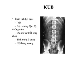 KUB
• Phân tích kết quả:
- Thận
- Bất thường đậm độ
đường niệu
- Dải mỡ cơ thắt lưng
chậu
- Tình trạng ổ bụng
- Hệ thống xương
 