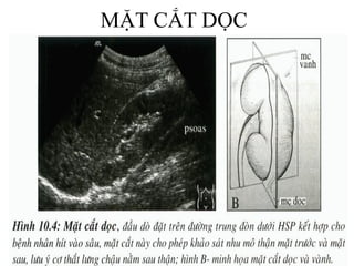 MẶT CẮT DỌC
 