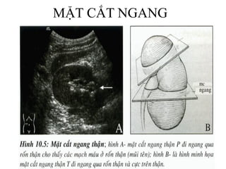 MẶT CẮT NGANG
 