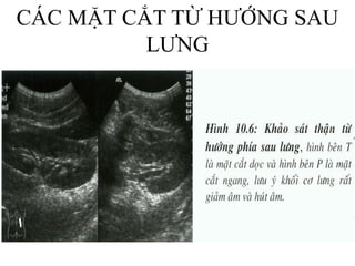 CÁC MẶT CẮT TỪ HƯỚNG SAU
LƯNG
 