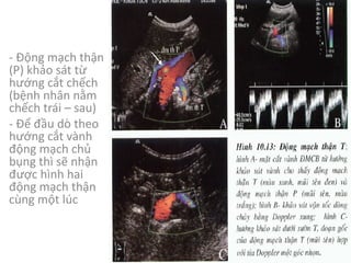 - Động mạch thận
(P)	khảo sát từ
hướng cắt chếch
(bệnh nhân nằm
chếch trái – sau)
- Để đầu dò theo
hướng cắt vành
động mạch chủ
bụng thì sẽ nhận
được hình hai
động mạch thận
cùng một lúc
 