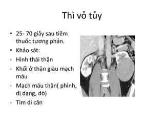 Thì vỏ tủy
• 25- 70	giây sau tiêm
thuốc tương phản.
• Khảo sát:
- Hình thái thận
- Khối ở	thận giàu mạch
máu
- Mạch máu thận(	phình,	
dị dạng,	dò)
- Tìm di	căn
 