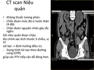 CT	scan	Niệu
quản
• Không thuốc tương phản.
- Chẩn đoán mức độ ứ	nước thận
(4	độ)
- Chẩn đoán nguyên nhân gây tắc
ngẽn:	
Sỏi niệu quản đoạn chậu.
Đo chính xác kích thước 3	chiều,	vị
trí
sỏi kẹt ->	định hướng điều trị.
- Dựng hình tái tạo theo đường
cong (CPR)
giúp các PTV	tiếp cận dễ đàng hơn.
 