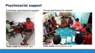 12
Psychosocial support
Individual psychosocial support Group psychosocial support
Photo credit: Leprosy Mission India
Photo credit: Martha Desir, Haiti
 