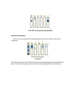 Liver function tests | PDF