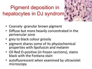 Pigment deposition in
hepatocytes in DJ syndrome
• Coarsely- granular brown pigment
• Diffuse but more heavily concentrated in the
perivenular zone
• grey to black colour grossly
• pigment shares some of its physiochemical
properties with lipofuscin and melanin
• Oil Red O-positive (in frozen sections), stains
black with the Fontana stain
• autofluorescent when examined by ultraviolet
microscopy
 