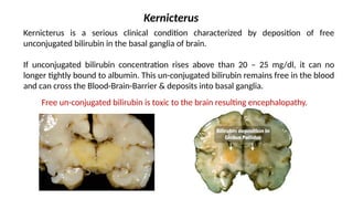 Kernicterus Features Comprehensive Overview of Bilirubin Metabolism and Jaundice Diagnosis ...