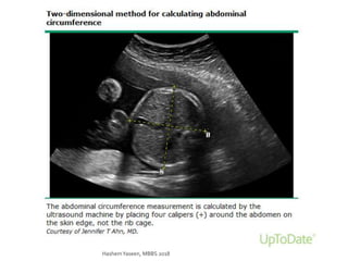 HashemYaseen, MBBS 2018
 