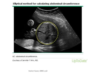 HashemYaseen, MBBS 2018
 