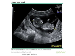 HashemYaseen, MBBS 2018
 