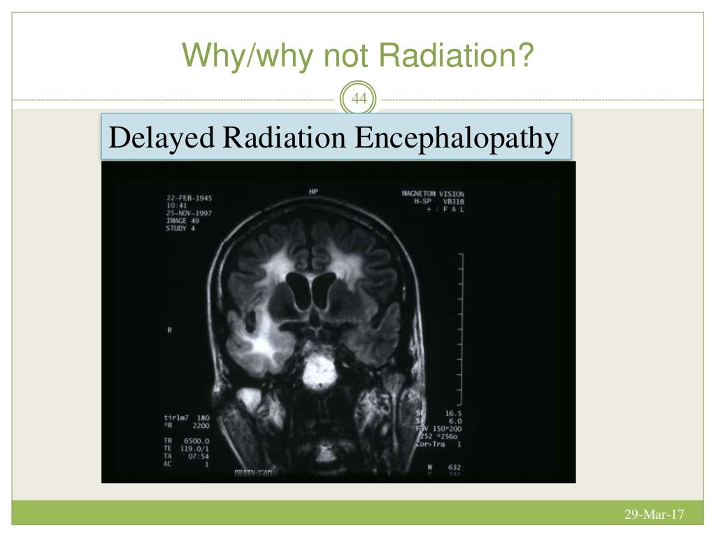 LOW GRADE GLIOMA controversies in management
