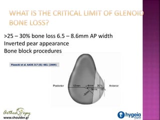 www.shoulder.gr
>25 – 30% bone loss 6.5 – 8.6mm AP width
Inverted pear appearance
Bone block procedures
Piasecki et al. AA...
