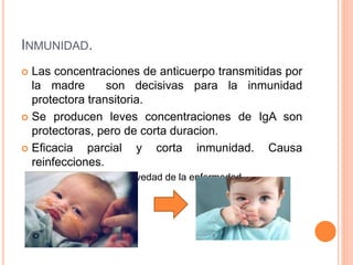 INMUNIDAD.
 Las concentraciones de anticuerpo transmitidas por
la madre son decisivas para la inmunidad
protectora transitoria.
 Se producen leves concentraciones de IgA son
protectoras, pero de corta duracion.
 Eficacia parcial y corta inmunidad. Causa
reinfecciones.
 Pero se mitiga la gravedad de la enfermedad.
 