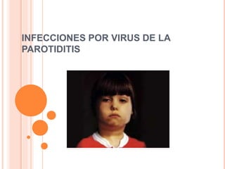 INFECCIONES POR VIRUS DE LA
PAROTIDITIS
 