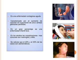  Es una enfermedad contagiosa aguda.
 Caracterizada por el aumento de
volumen sin supuración de una o ambas
glándulas parótidas.
 En un gran porcentaje es una
enfermedad infantil leve.
 En los adultos las complicaciones mas
comunes son meningitis y otitis.
 Se calcula que el 20% y el 30% de los
casos son asintomáticos.
 