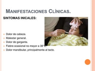 MANIFESTACIONES CLÍNICAS.
SINTOMAS INICALES:
 Dolor de cabeza.
 Malestar general.
 Dolor de garganta.
 Fiebre ocasional no mayor a 38°C.
 Dolor mandibular, principalmente al tacto.
 