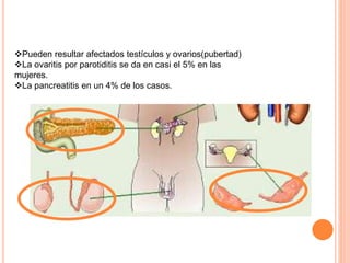 Pueden resultar afectados testículos y ovarios(pubertad)
La ovaritis por parotiditis se da en casi el 5% en las
mujeres.
La pancreatitis en un 4% de los casos.
 