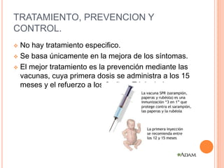 TRATAMIENTO, PREVENCION Y
CONTROL.
 No hay tratamiento especifico.
 Se basa únicamente en la mejora de los síntomas.
 El mejor tratamiento es la prevención mediante las
vacunas, cuya primera dosis se administra a los 15
meses y el refuerzo a los 6 años- Tripleviral.
 