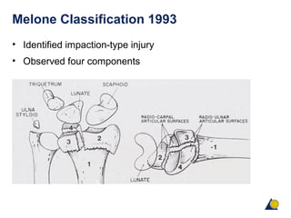 Melone Classification 1993
• Identified impaction-type injury
• Observed four components
 