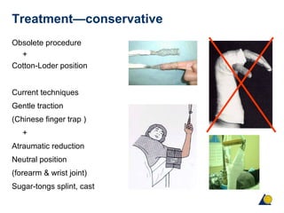 Treatment—conservative
Obsolete procedure
+
Cotton-Loder position
Current techniques
Gentle traction
(Chinese finger trap )
+
Atraumatic reduction
Neutral position
(forearm & wrist joint)
Sugar-tongs splint, cast
 