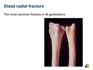 Distal radial fracture
The most common fracture in all generations
 