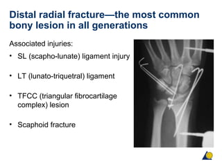 Distal radial fracture—the most common
bony lesion in all generations
Associated injuries:
• SL (scapho-lunate) ligament injury
• LT (lunato-triquetral) ligament injury
• TFCC (triangular fibrocartilage
complex) lesion
• Scaphoid fracture
 