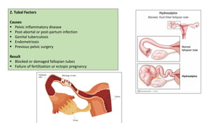 Infertility Overview Comprehensive Overview of Infertility: Causes, Diagnosis, and ...