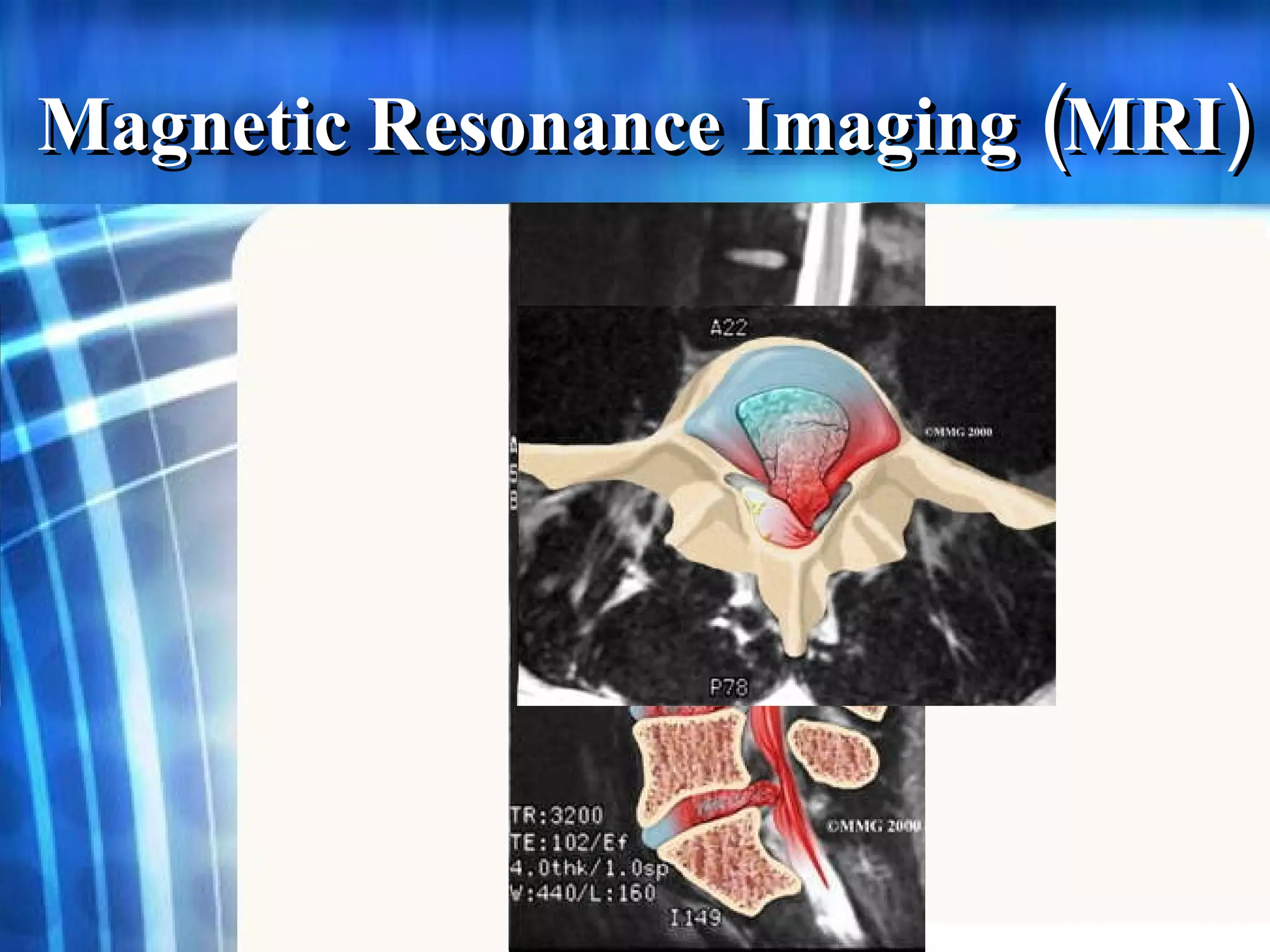 Magnetic Resonance Imaging  ( MRI) 