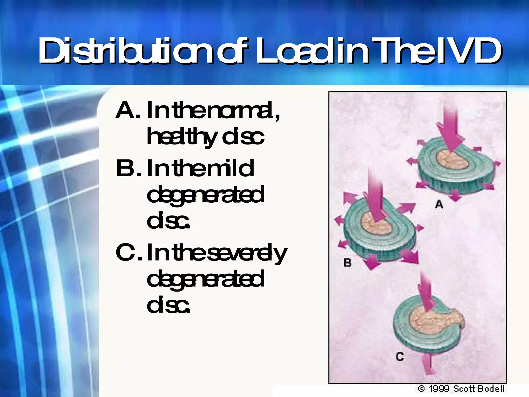 Distribution of Load in The IVD In the normal, healthy disc In the mild degenerated disc. In the severely degenerated disc. 