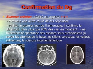 Confirmation du Dg   Scanner crânien  : réalisé en urgence  +++ - éliminera une autre cause de ces céphalées - réalisé, le premier jour de l’hémorragie, il confirme le diagnostic dans plus que 95% des cas, en montrant : une hyperdensité spontanée des espaces sous-archnoidiens (a savoir les citernes de la base, les sillons corticaux, les vallées sylviennes, la scissure interhémishérique 
