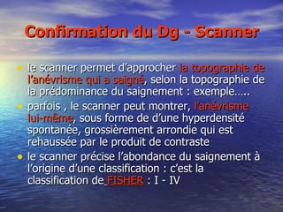 Confirmation du Dg - Scanner le scanner permet d’approcher  la topographie de l’anévrisme qui a saigné , selon la topographie de la prédominance du saignement : exemple….. parfois , le scanner peut montrer,  l’anévrisme lui-même , sous forme de d’une hyperdensité spontanée, grossièrement arrondie qui est rehaussée par le produit de contraste le scanner précise l’abondance du saignement à l’origine d’une classification : c’est la classification de   FISHER  : I - IV 