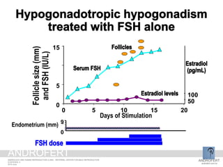 0
9
Endometrium (mm)
0
5
10
15
0 5 10 15 20
Days of Stimulation
50
100
Folliclesize(mm)
andFSH(IU/L)
ANDROFERT
androfert.com.br
ANDROLOGY AND HUMAN REPRODUCTION CLINIC - REFERRAL CENTER FOR MALE REPRODUCTION
S ESTEVES, 5
2014 June
ANDROFERT
 