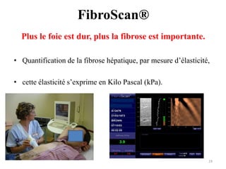 FibroScan®
  Plus le foie est dur, plus la fibrose est importante.

• Quantification de la fibrose hépatique, par mesure d’élasticité,

• cette élasticité s’exprime en Kilo Pascal (kPa).




                                                                 19
 