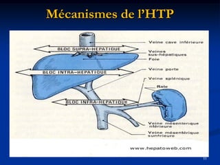 Mécanismes de l’HTP




                      11
 