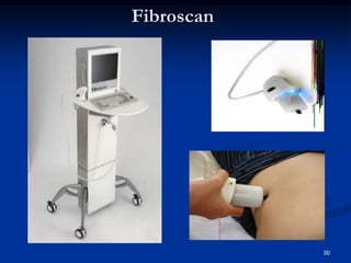 Fibroscan




            30
 