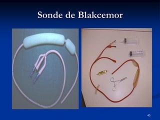 Sonde de Blakcemor




                     43
 