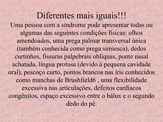 Diferentes mais iguais!!! 
Uma pessoa com a síndrome pode apresentar todas ou 
algumas das seguintes condições físicas: olhos 
amendoados, uma prega palmar transversal única 
(também conhecida como prega simiesca), dedos 
curtinhos, fissuras palpebrais oblíquas, ponte nasal 
achatada, língua protusa (devido à pequena cavidade 
oral), pescoço curto, pontos brancos nas íris conhecidos 
como manchas de Brushfield6 , uma flexibilidade 
excessiva nas articulações, defeitos cardíacos 
congênitos, espaço excessivo entre o hálux e o segundo 
dedo do pé. 
 