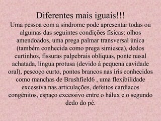 Diferentes mais iguais!!! 
Uma pessoa com a síndrome pode apresentar todas ou 
algumas das seguintes condições físicas: olhos 
amendoados, uma prega palmar transversal única 
(também conhecida como prega simiesca), dedos 
curtinhos, fissuras palpebrais oblíquas, ponte nasal 
achatada, língua protusa (devido à pequena cavidade 
oral), pescoço curto, pontos brancos nas íris conhecidos 
como manchas de Brushfield6 , uma flexibilidade 
excessiva nas articulações, defeitos cardíacos 
congênitos, espaço excessivo entre o hálux e o segundo 
dedo do pé. 
 