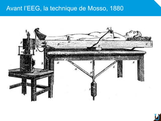 Avant l’EEG, la technique de Mosso, 1880
 