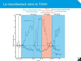 Le neurofeedack dans le TDAH
Drug + Augmentation béta
Diminution théta
Drug +
Diminution béta
Augmentation théta
Drug + Au...