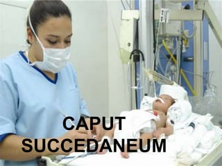 CAPUT
SUCCEDANEUM