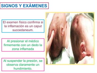 SIGNOS Y EXÁMENES
El examen físico confirma si
la inflamación es un caput
succedaneum.
Al presionar el médico
firmemente con un dedo la
zona inflamada
Al suspender la presión, se
observa claramente un
hundimiento.
