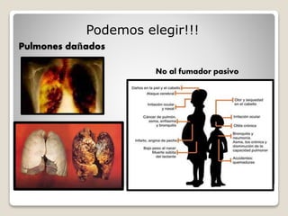 Pulmones dañados
Podemos elegir!!!
No al fumador pasivo
 