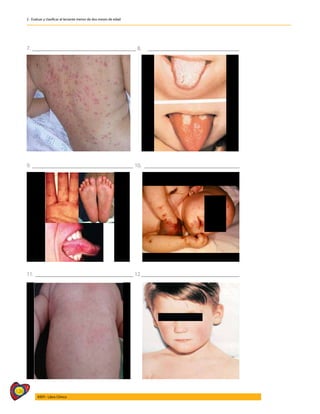 126
AIEPI - Libro Clínico
2 - Evaluar y clasificar al lactante menor de dos meses de edad
7._____________________________________ 8. _________________________________
9.____________________________________ 10. __________________________________
11.___________________________________ 12.___________________________________
 