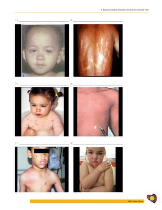 127
AIEPI - Libro Clínico
2 - Evaluar y clasificar al lactante menor de dos meses de edad
13.___________________________________ 14.___________________________________
15.___________________________________ 16.___________________________________
17.___________________________________ 18.___________________________________
 